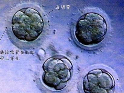 成都做试管大概需要多少钱？试管婴儿是多少钱？